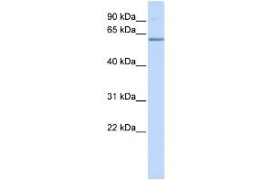 WB Suggested Anti-TRIM16 Antibody Titration:  0. (TRIM16 抗体  (N-Term))