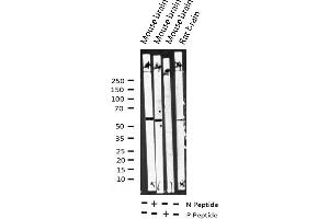 Western blot analysis of Phospho-Dab1 (Tyr232) expression in various lysates (DAB1 抗体  (pTyr232))
