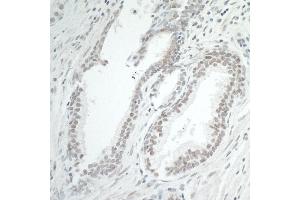Immunohistochemistry (IHC) image for anti-Bromodomain Containing 7 (BRD7) (AA 601-651) antibody (ABIN7454819)