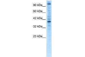 WB Suggested Anti-ZNF624 Antibody Titration:  0. (ZNF624 抗体  (Middle Region))