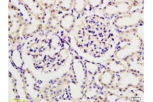 Formalin-fixed and paraffin embedded rat kidney tissue labeled with Rabbit Anti-Podoplanin/gp36 Polyclonal Antibody , Unconjugated 1:200 followed by conjugation to the secondary antibody and DAB staining