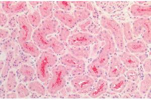 Immunohistochemistry analysis using Rabbit Anti-Tau Polyclonal Antibody (ABIN6698772). (tau 抗体  (Biotin))