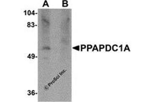 Western Blotting (WB) image for anti-Phosphatidic Acid Phosphatase Type 2 Domain Containing 1A (PPAPDC1A) (C-Term) antibody (ABIN1030596) (PPAPDC1A 抗体  (C-Term))
