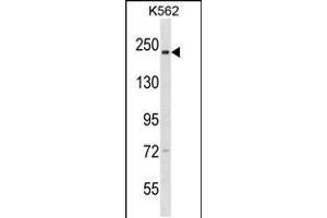 Western blot analysis in K562 cell line lysates (35ug/lane). (NCAPD3 抗体  (C-Term))