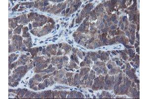 Image no. 3 for anti-Prefoldin Subunit 3 (PFDN3) antibody (ABIN1501707)