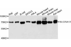 Western blot analysis of extracts of various cell lines, using SLC25A12 antibody (ABIN4905188) at 1:3000 dilution. (SLC25A12 抗体)