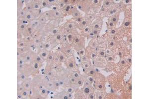 Used in DAB staining on fromalin fixed paraffin- embedded liver tissue (TREX1 抗体  (AA 6-369))