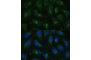 Immunofluorescence (IF) image for anti-Sulfotransferase Family, Cytosolic, 1C, Member 4 (SULT1C4) (AA 1-95) antibody (ABIN7270631)