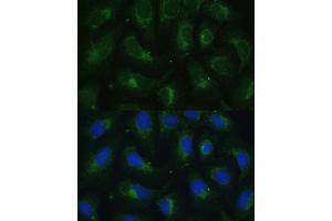 Immunofluorescence analysis of U-2 OS cells using SULT1C4 antibody (ABIN7270631) at dilution of 1:100. (SULT1C4 抗体  (AA 1-95))