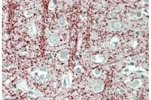 AP21274PU-N TPPP Antibody staining of paraffin embedded Human Cerebral Cortex at 3. (Tppp 抗体  (Internal Region))