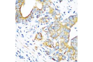 Immunohistochemistry of paraffin-embedded human stomach using MT-CO2 antibody (ABIN5997496) at dilution of 1/100 (40x lens). (COX2 抗体)