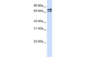 WB Suggested Anti-SF1 Antibody Titration:  0. (Splicing Factor 1 抗体  (N-Term))