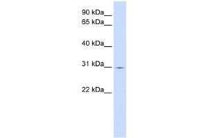 WB Suggested Anti-ZNF501 Antibody Titration:  0.