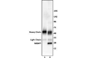 MGMT antibody (pAb) tested by Immunoprecipitation. (MGMT 抗体  (C-Term))