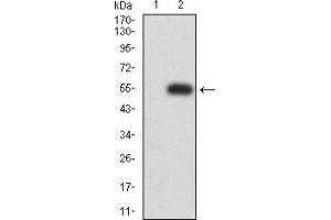 Western blot analysis using P2RX7 mAb against HEK293 (1) and P2RX7 (AA: 226-452)-hIgGFc transfected HEK293 (2) cell lysate. (P2RX7 抗体  (AA 226-452))