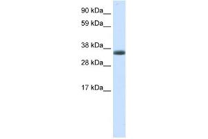 Western Blotting (WB) image for anti-Excision Repair Cross-Complementing Rodent Repair Deficiency, Complementation Group 8 (ERCC8) (N-Term) antibody (ABIN2779478)