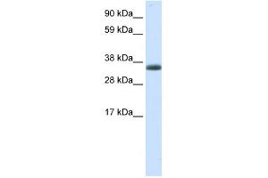 WB Suggested Anti-ERCC8 Antibody Titration:  0. (ERCC8 抗体  (N-Term))