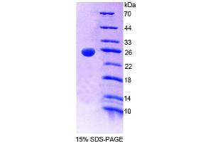 SDS-PAGE analysis of Mouse GCA Protein. (Grancalcin 蛋白)