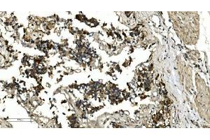 IHC analysis of HDAC4 using anti-HDAC4 antibody (ABIN5518841). (HDAC4 抗体  (AA 4-213))