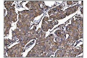 IHC analysis of POGLUT1 using anti-POGLUT1 antibody (ABIN7602910). (POGLUT1 抗体  (C-Term))