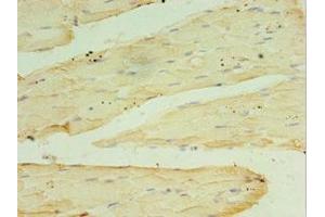 Immunohistochemistry of paraffin-embedded human skeletal muscle tissue using ABIN7166948 at dilution of 1:100 (RPH3AL 抗体  (AA 161-315))