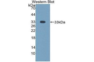 Western Blotting (WB) image for anti-Neuronal Pentraxin II (NPTX2) antibody (ABIN1865403) (NPTX2 抗体)