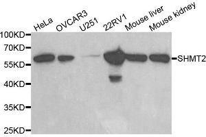 Western blot analysis of extracts of various cell lines, using SHMT2 antibody. (SHMT2 抗体)