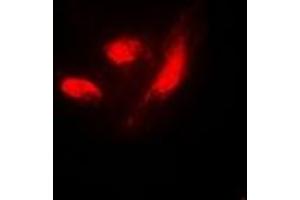 Immunofluorescent analysis of IRF3 (pS385) staining in HeLa cells. (IRF3 抗体  (C-Term, pSer385))
