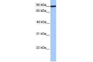 WB Suggested Anti-ADAM2 Antibody Titration: 0. (ADAM2 抗体  (Middle Region))