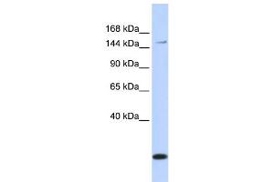 WB Suggested Anti-ABCC3 Antibody Titration:  0. (ABCC3 抗体  (Middle Region))