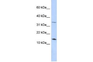 WB Suggested Anti-LEP Antibody Titration:  0.