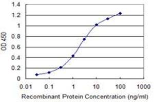 Detection limit for recombinant GST tagged TIAM2 is 0. (TIAM2 抗体  (AA 527-624))