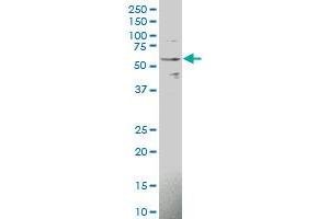 Western Blotting (WB) image for anti-Interleukin 1 Receptor, Type I (IL1R1) (AA 18-127) antibody (ABIN561452)