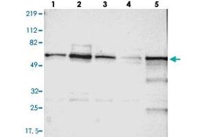 Western blot analysis of Lane 1: RT-4, Lane 2: U-251 MG, Lane 3: A-431, Lane 4: Liver, Lane 5: Tonsil with UPF3B polyclonal antibody  at 1:250-1:500 dilution. (UPF3B 抗体)