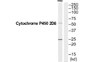 Western Blotting (WB) image for anti-Cytochrome P450, Family 2, Subfamily D, Polypeptide 6 (CYP2D6) (C-Term) antibody (ABIN1575966)