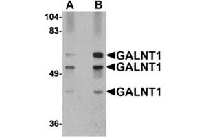 Western Blotting (WB) image for anti-UDP-N-Acetyl-alpha-D-Galactosamine:polypeptide N-Acetylgalactosaminyltransferase 10 (GalNAc-T10) (GALNT10) (N-Term) antibody (ABIN1031390) (GALNT10 抗体  (N-Term))