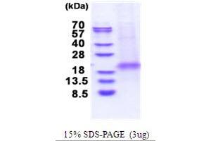 SDS-PAGE (SDS) image for XiAP Associated Factor 1 (XAF1) (AA 1-125) protein (His tag) (ABIN5853700)