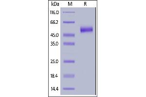 Human IL-13 R alpha 2, His Tag on  under reducing (R) condition. (IL13RA2 Protein (AA 27-343) (His tag))