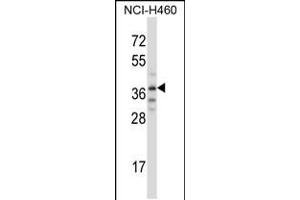 Western blot analysis in NCI-H460 cell line lysates (35ug/lane). (TRIM31 抗体  (C-Term))