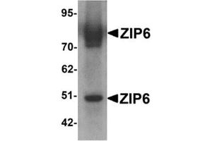 Western blot analysis of ZIP6 in mouse lung tissue lysate with ZIP6 antibody at 1 μg/ml. (SLC39A6 抗体  (Center))
