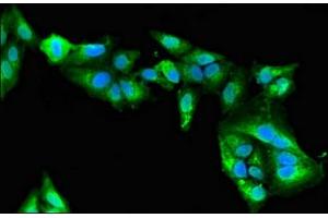 Immunofluorescent analysis of Hela cells using ABIN7160604 at dilution of 1:100 and Alexa Fluor 488-congugated AffiniPure Goat Anti-Rabbit IgG(H+L) (MYBPC2 抗体  (AA 739-1141))