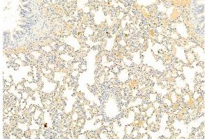 ABIN6261472 and ABIN6269092 at 1/100 staining Rat lung tissue by IHC-P.