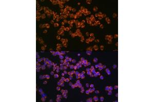 Immunofluorescence analysis of K562 cells using CD127/IL7R Rabbit mAb (ABIN7268005) at dilution of 1:100 (40x lens). (IL7R 抗体)