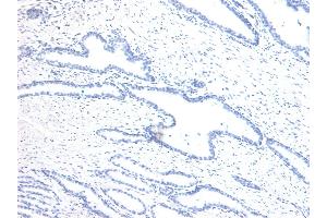 (ABIN6391406) Negative Control showing staining of paraffin embedded Human Prostate, with no primary antibody. (Homeobox D13 抗体  (Internal Region))