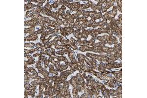Immunohistochemical staining of human liver with ZNF629 polyclonal antibody  shows strong cytoplasmic positivity in hepatocytes at 1:50-1:200 dilution. (Zinc Finger Protein 629 (ZNF629) 抗体)