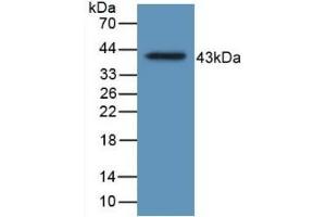 Detection of Recombinant HJV, Human using Monoclonal Antibody to Hemojuvelin (HJV)