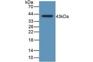 Detection of Recombinant HJV, Human using Monoclonal Antibody to Hemojuvelin (HJV) (HFE2 抗体  (AA 29-401))