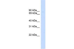 WB Suggested Anti-ZNF483 Antibody Titration:  0. (ZNF483 抗体  (Middle Region))