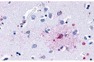 Anti-GPR139 antibody  ABIN1048722 IHC staining of human brain, neurons and glia. (GPR139 抗体  (Cytoplasmic Domain))