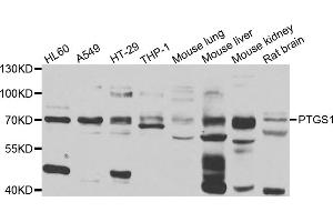 Western blot analysis of extracts of various cell lines, using PTGS1 antibody. (PTGS1 抗体)